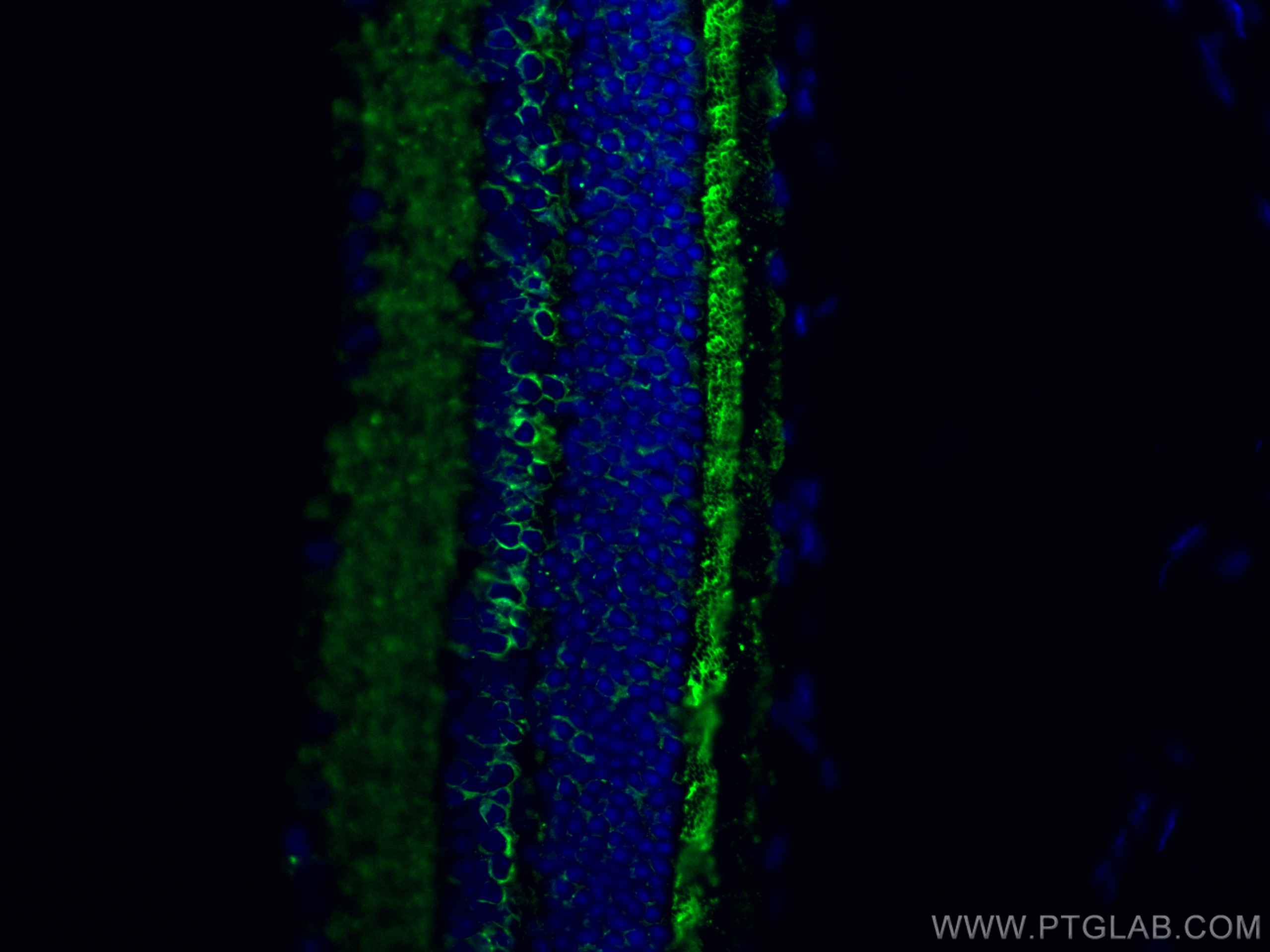 Immunofluorescence (IF) / fluorescent staining of mouse eye tissue using RS1 Polyclonal antibody (24430-1-AP)