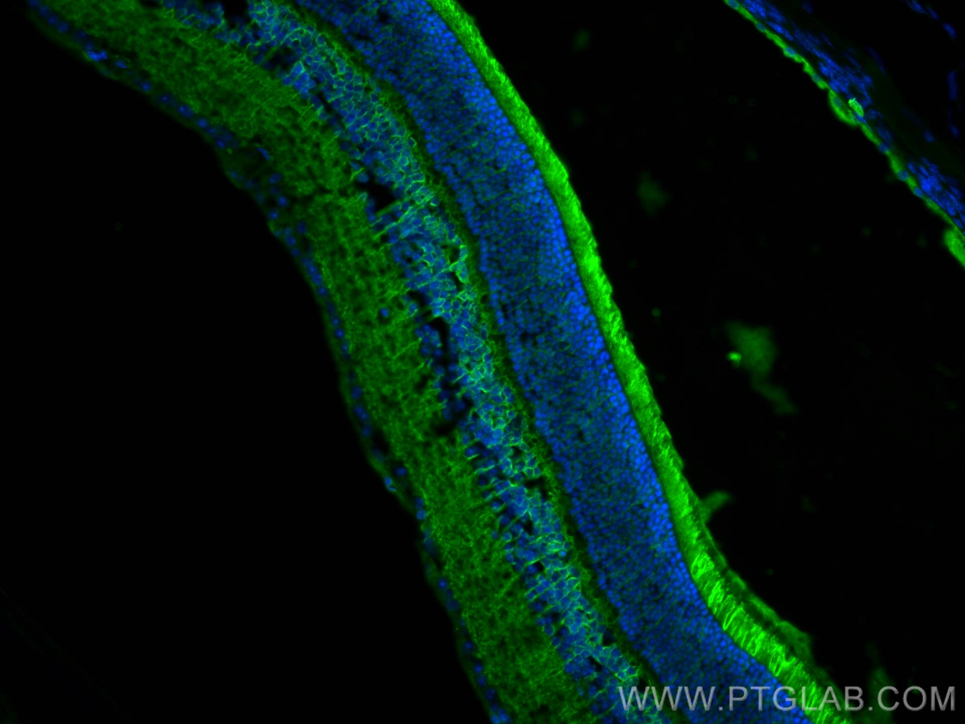Immunofluorescence (IF) / fluorescent staining of mouse eye tissue using RS1 Polyclonal antibody (24430-1-AP)