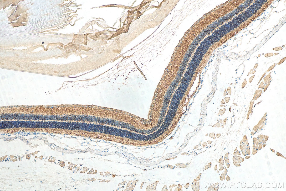 Immunohistochemistry (IHC) staining of mouse eye tissue using RS1 Polyclonal antibody (24430-1-AP)