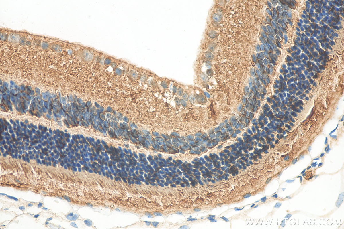 Immunohistochemistry (IHC) staining of mouse eye tissue using RS1 Polyclonal antibody (24430-1-AP)