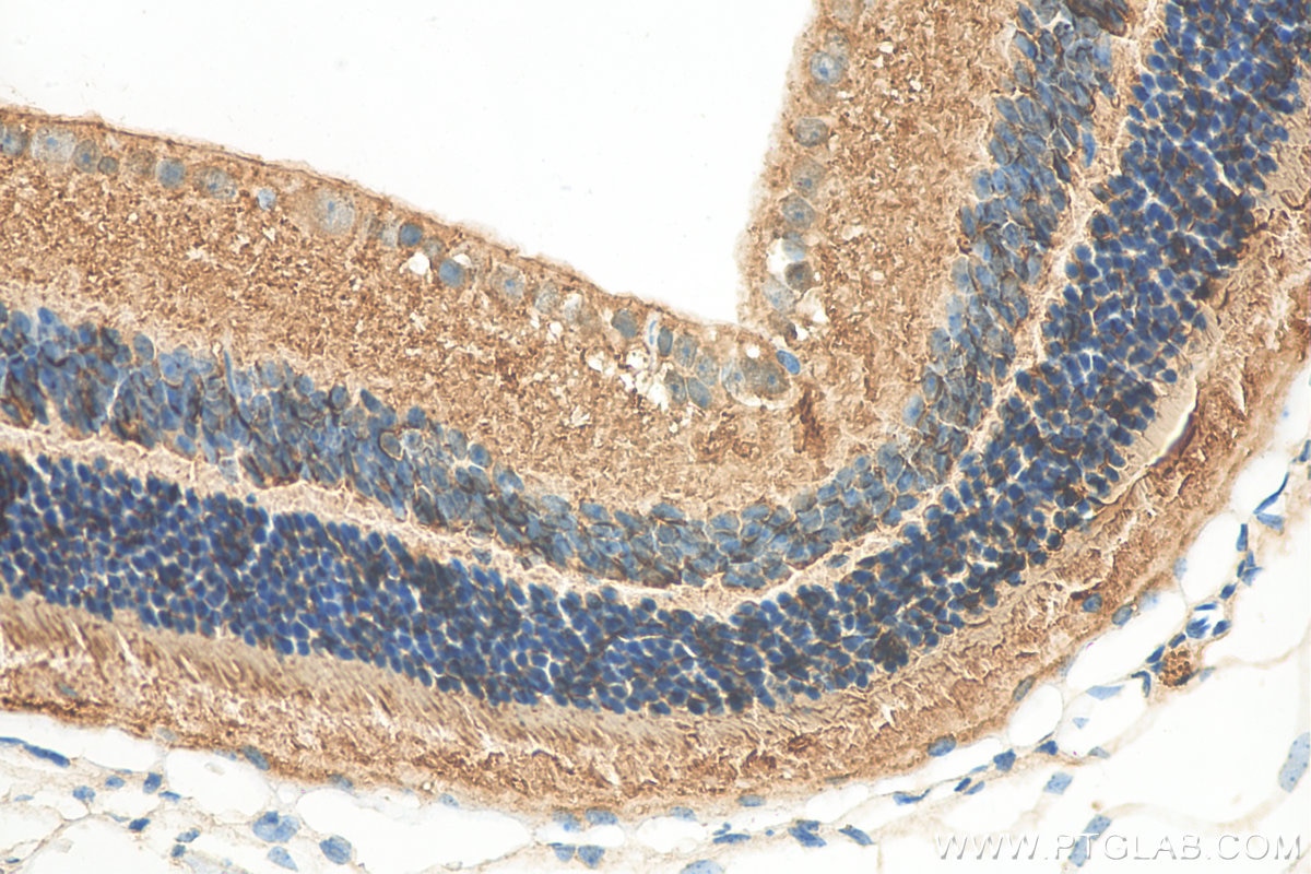 IHC staining of mouse eye using 24430-1-AP