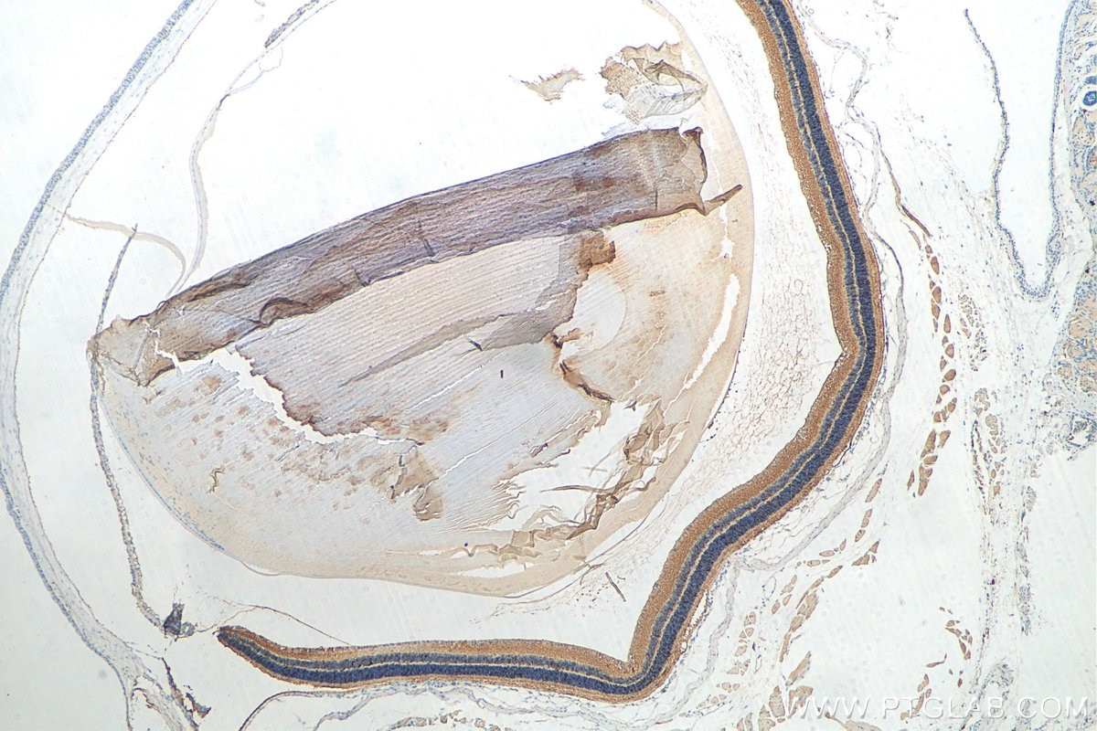 Immunohistochemistry (IHC) staining of mouse eye tissue using RS1 Polyclonal antibody (24430-1-AP)