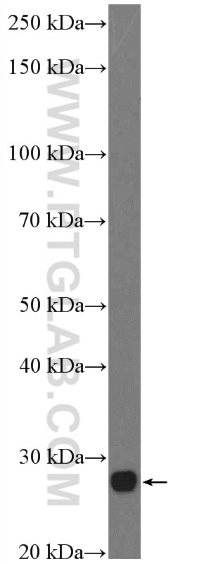 Western Blot (WB) analysis of mouse eye tissue using RS1 Polyclonal antibody (24430-1-AP)