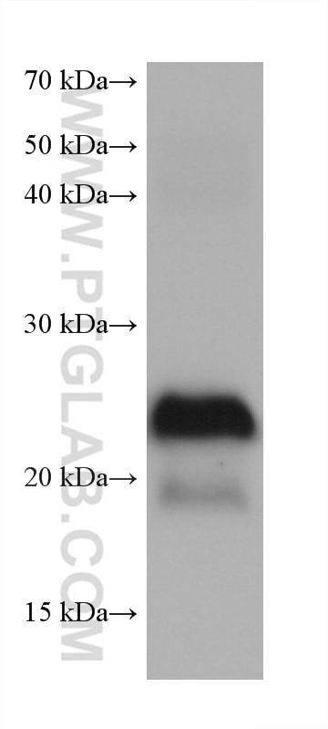 WB analysis of mouse retina using 68654-1-Ig