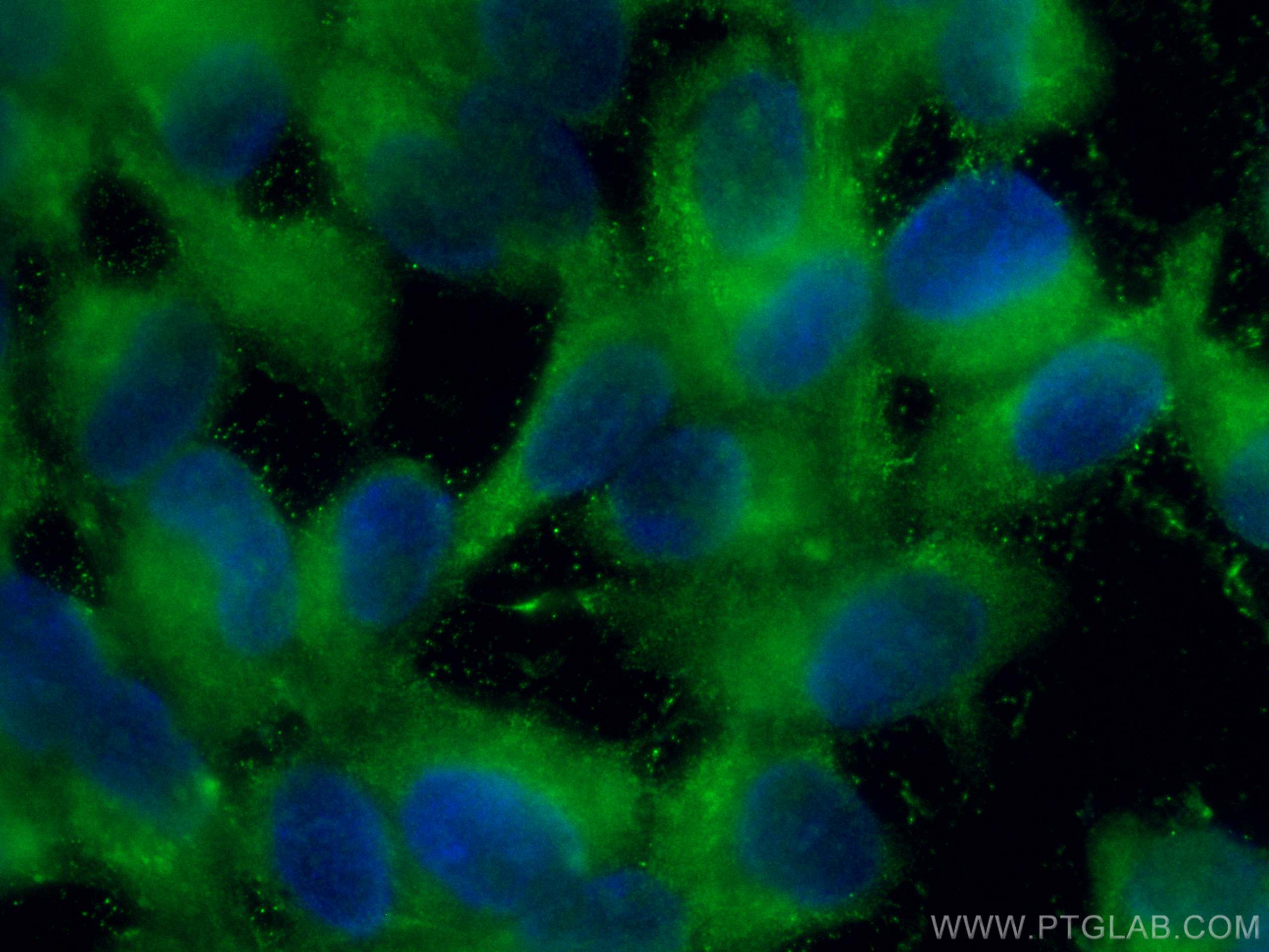 Immunofluorescence (IF) / fluorescent staining of hTERT-RPE1 cells using CoraLite® Plus 488-conjugated RS1 Polyclonal antib (CL488-24430)