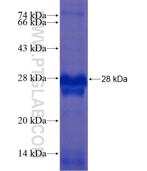 RS1 fusion protein Ag18885 SDS-PAGE