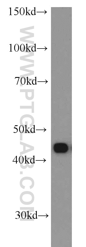 RSAD2 Polyclonal antibody