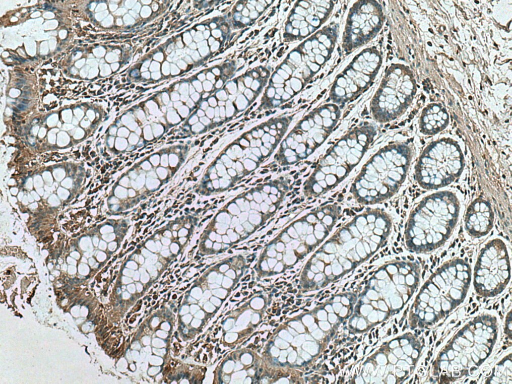 Immunohistochemistry (IHC) staining of human colon tissue using RSAD2 Polyclonal antibody (28089-1-AP)