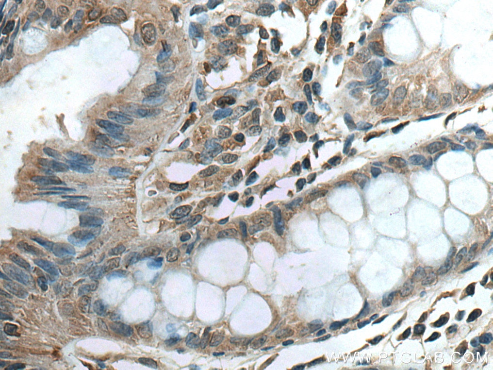 Immunohistochemistry (IHC) staining of human colon tissue using RSAD2 Polyclonal antibody (28089-1-AP)