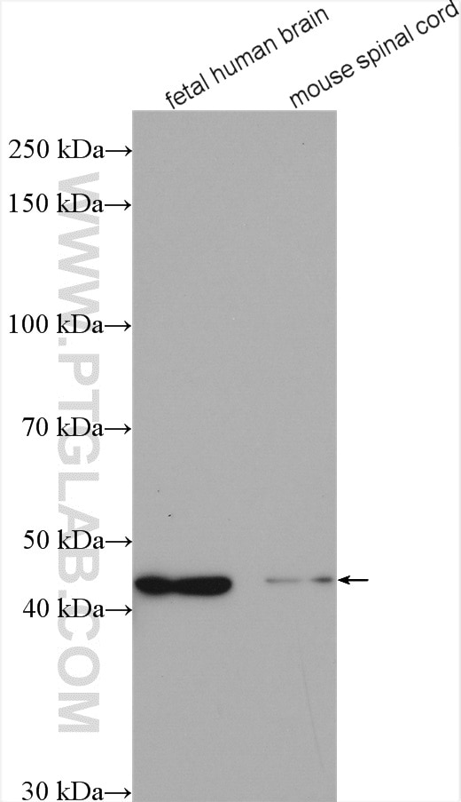 Western Blot (WB) analysis of various lysates using RSAD2 Polyclonal antibody (28089-1-AP)