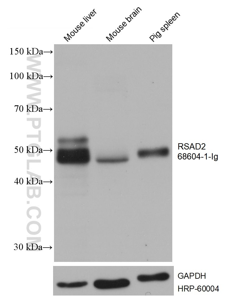 RSAD2