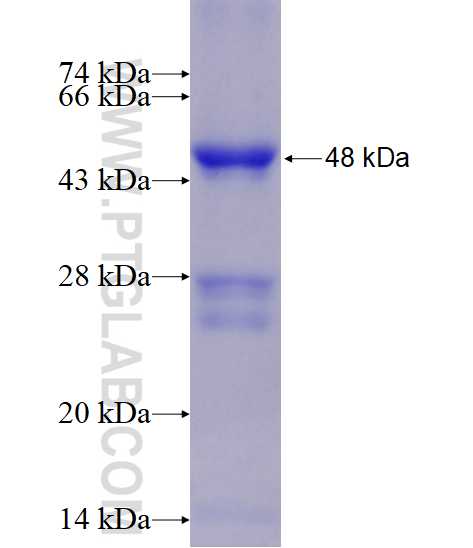 RSAD2 fusion protein Ag15174 SDS-PAGE