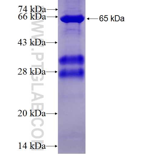 RSAD2 fusion protein Ag2409 SDS-PAGE