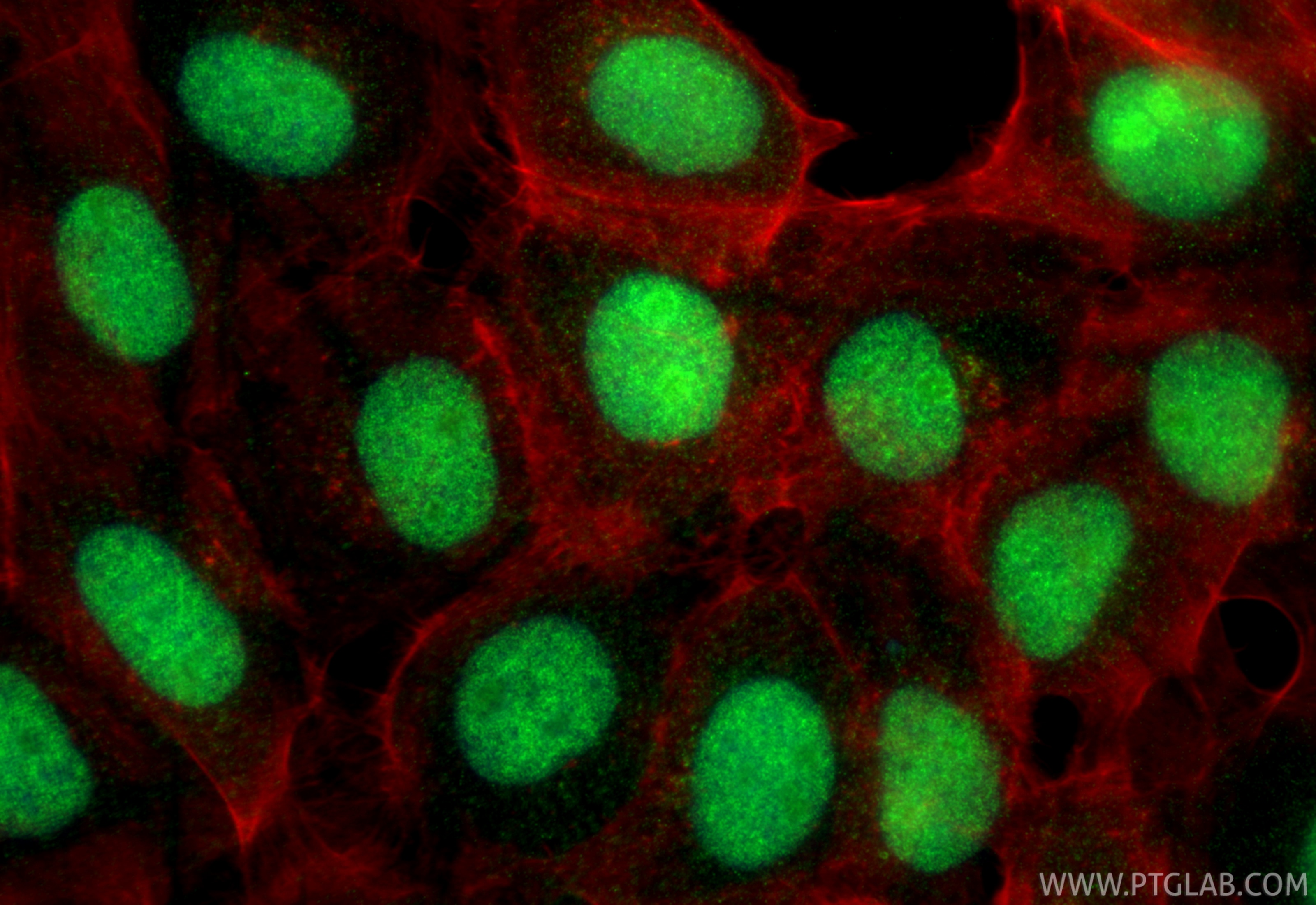 IF Staining of A431 using 24734-1-AP (same clone as 24734-1-PBS) Immunofluorescence (IF) / fluorescent staining of A431 cells using RSBN1 Polyclonal antibody (24734-1-AP)