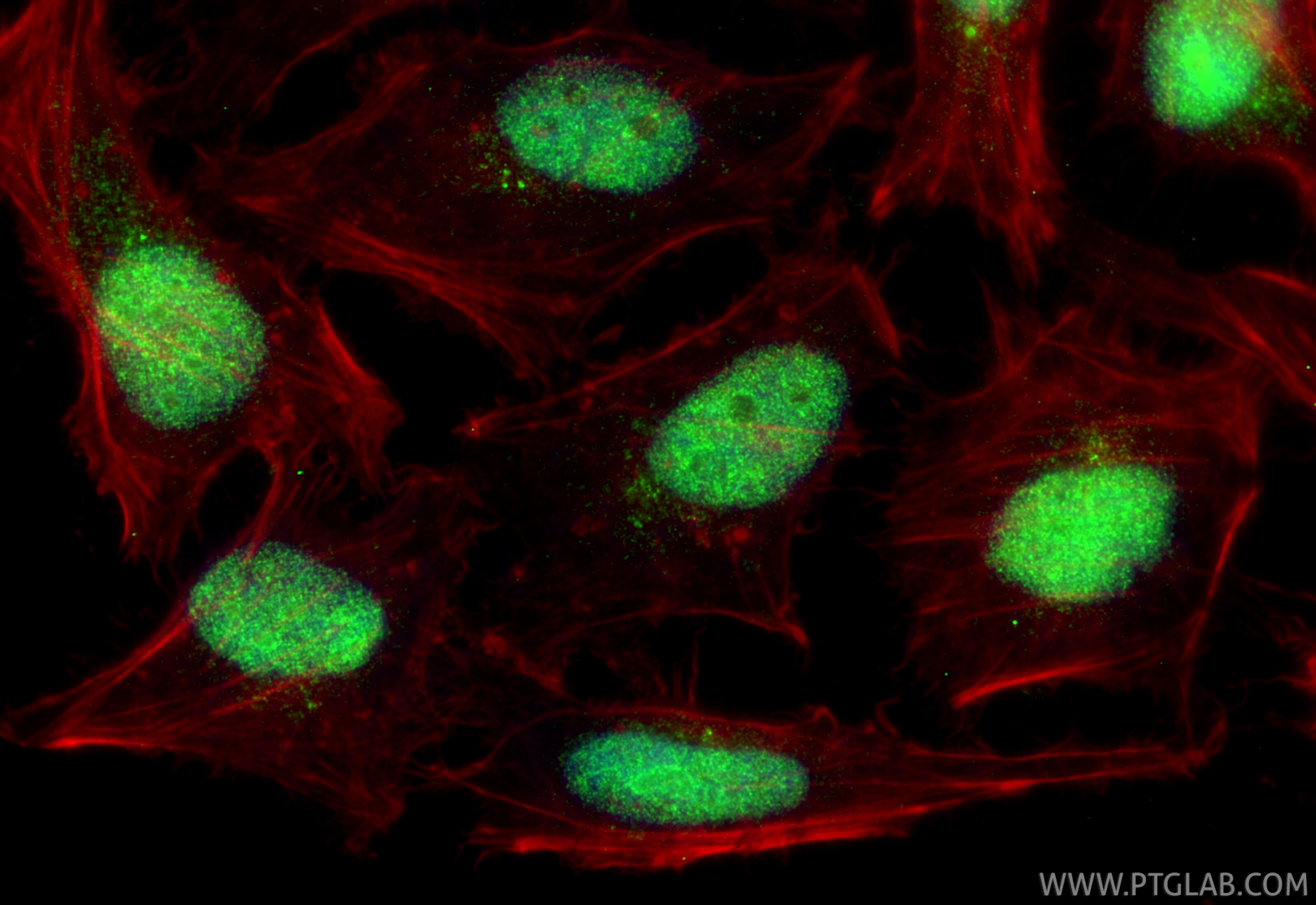 IF Staining of HeLa using 24734-1-AP (same clone as 24734-1-PBS) Immunofluorescence (IF) / fluorescent staining of HeLa cells using RSBN1 Polyclonal antibody (24734-1-AP)