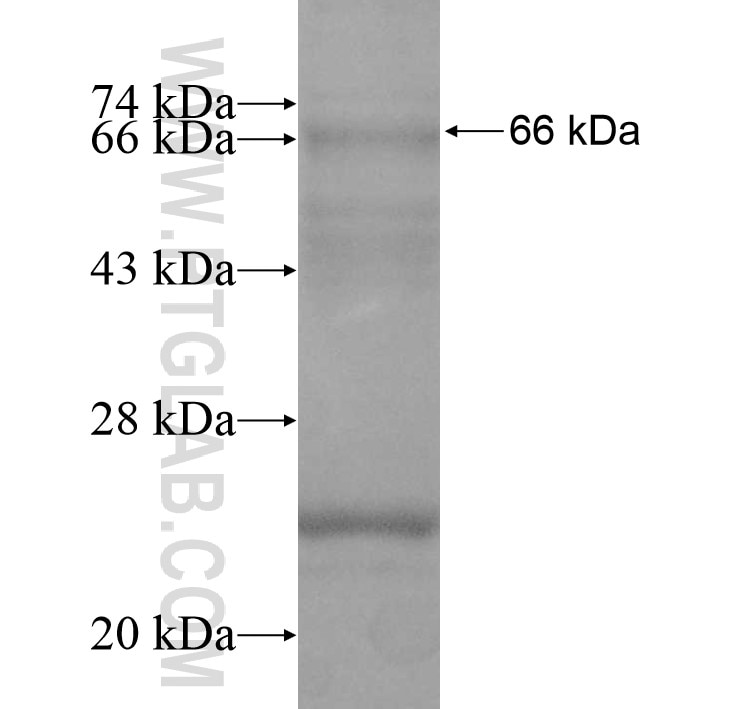 RSBN1L fusion protein Ag11539 SDS-PAGE