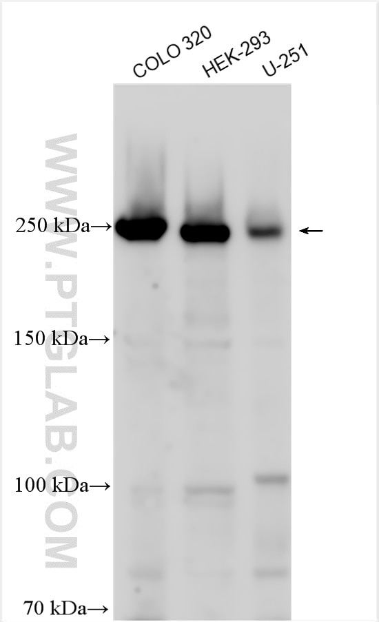 Western Blot (WB) analysis of various lysates using RSF1 Polyclonal antibody (26011-1-AP)
