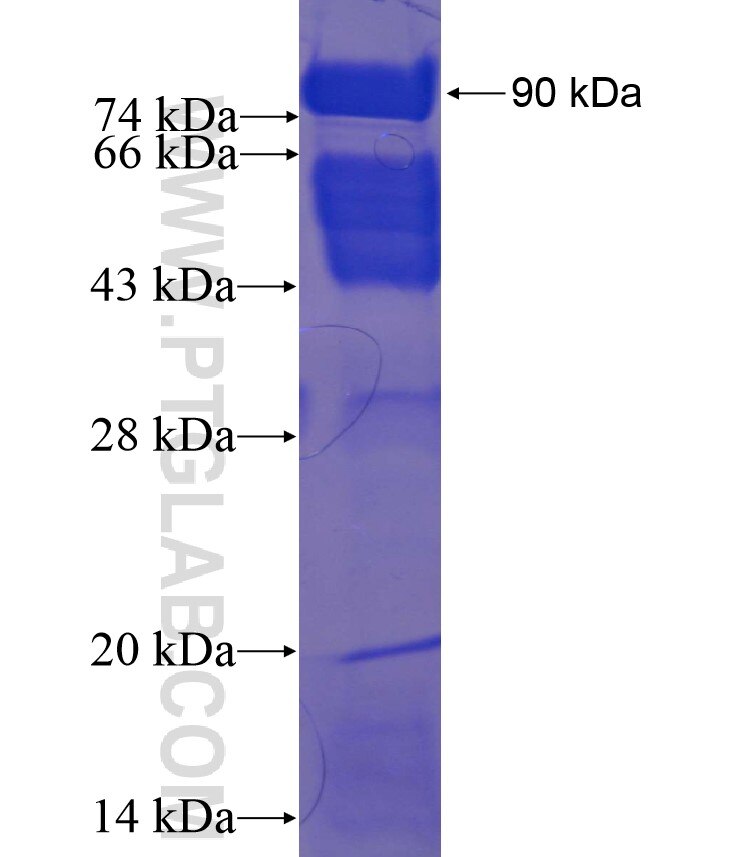 RSF1 fusion protein Ag22456 SDS-PAGE