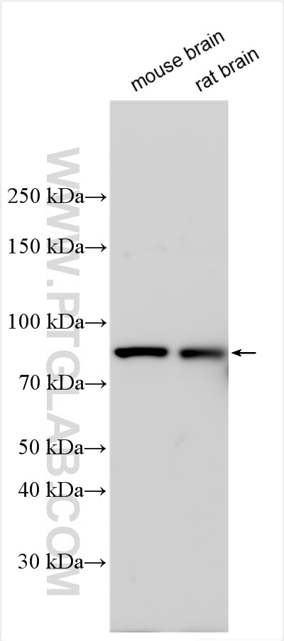 Western Blot (WB) analysis of various lysates using RSK4 Polyclonal antibody (21877-1-AP)