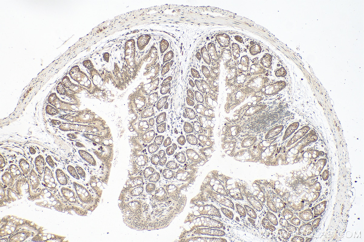 Immunohistochemistry (IHC) staining of mouse colon tissue using RSL1D1 Polyclonal antibody (27667-1-AP)