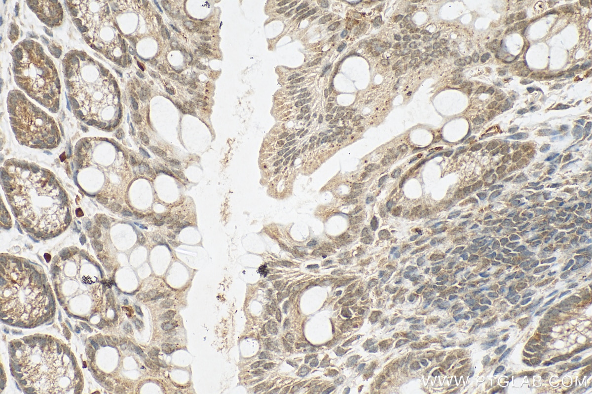Immunohistochemistry (IHC) staining of mouse colon tissue using RSL1D1 Polyclonal antibody (27667-1-AP)