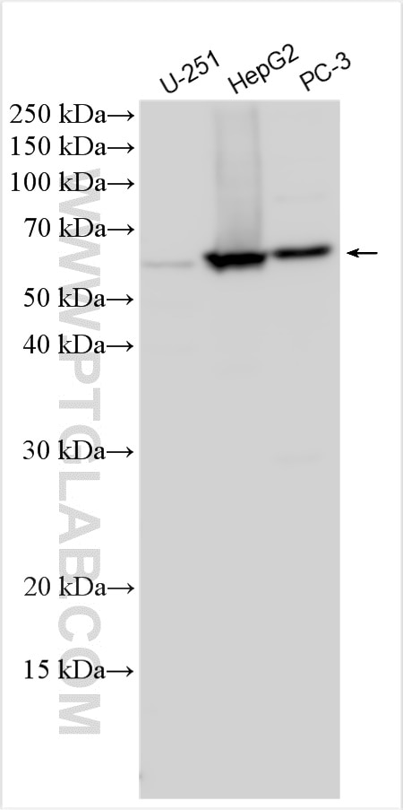 Western Blot (WB) analysis of various lysates using RSL1D1 Polyclonal antibody (27667-1-AP)