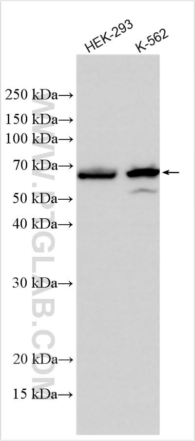 Western Blot (WB) analysis of various lysates using RSL1D1 Polyclonal antibody (27667-1-AP)