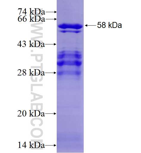 RSL1D1 fusion protein Ag24923 SDS-PAGE