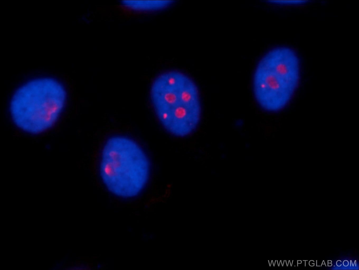 Immunofluorescence (IF) / fluorescent staining of HepG2 cells using RSL24D1 Polyclonal antibody (25190-1-AP)