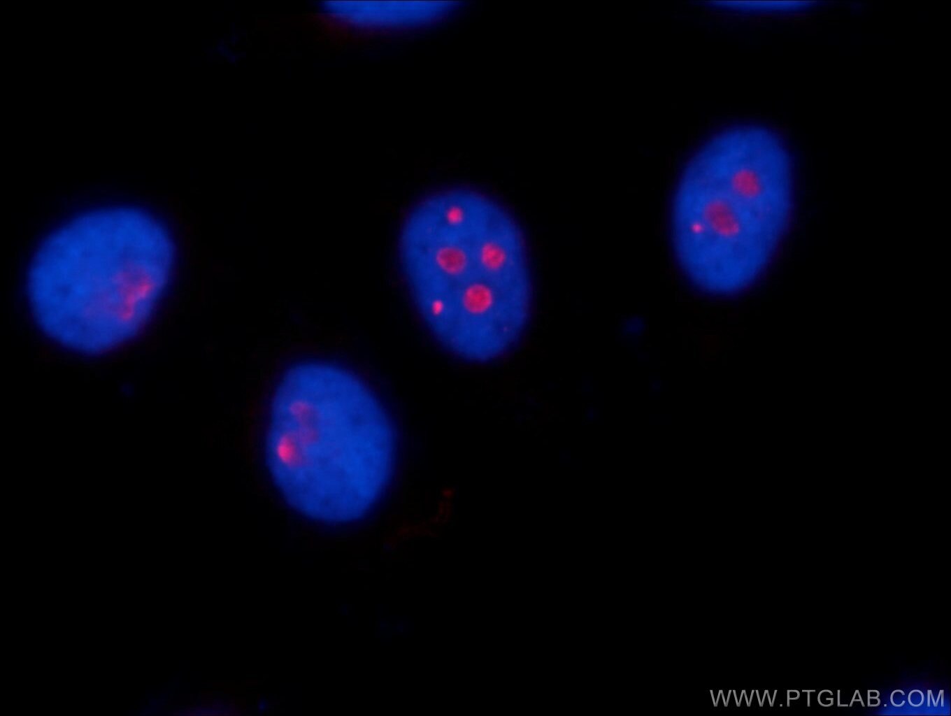 IF Staining of HepG2 using 25190-1-AP