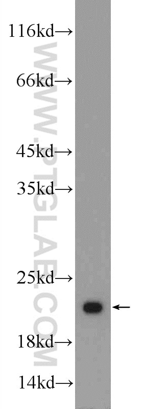 Western Blot (WB) analysis of PC-3 cells using RSL24D1 Polyclonal antibody (25190-1-AP)