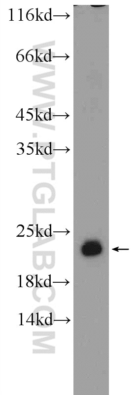 Western Blot (WB) analysis of HL-60 cells using RSL24D1 Polyclonal antibody (25190-1-AP)