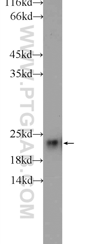 Western Blot (WB) analysis of HepG2 cells using RSL24D1 Polyclonal antibody (25190-1-AP)