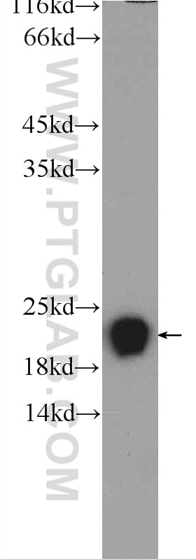 Western Blot (WB) analysis of HepG2 cells using RSL24D1 Polyclonal antibody (25190-1-AP)
