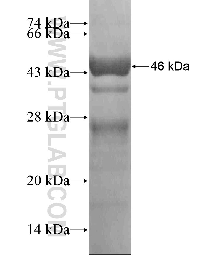 RSL24D1 fusion protein Ag18195 SDS-PAGE