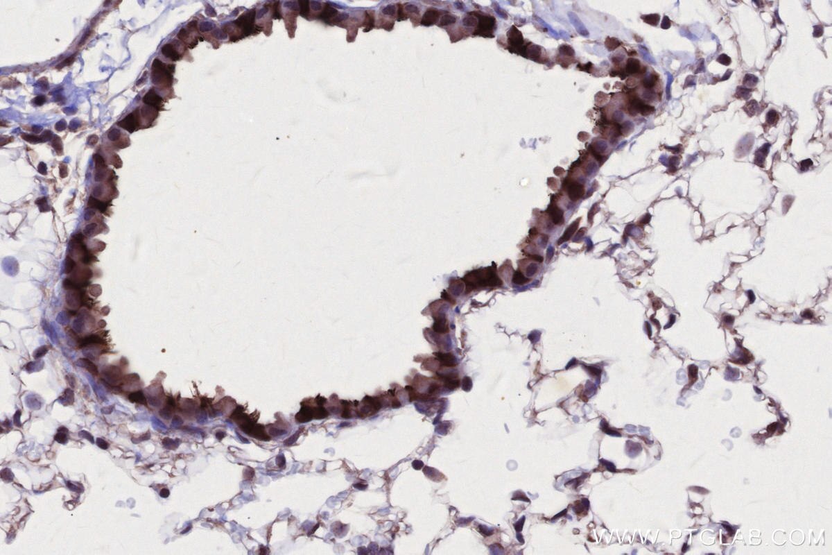 Immunohistochemistry (IHC) staining of mouse lung tissue using RSPH1 Polyclonal antibody (32033-1-AP)