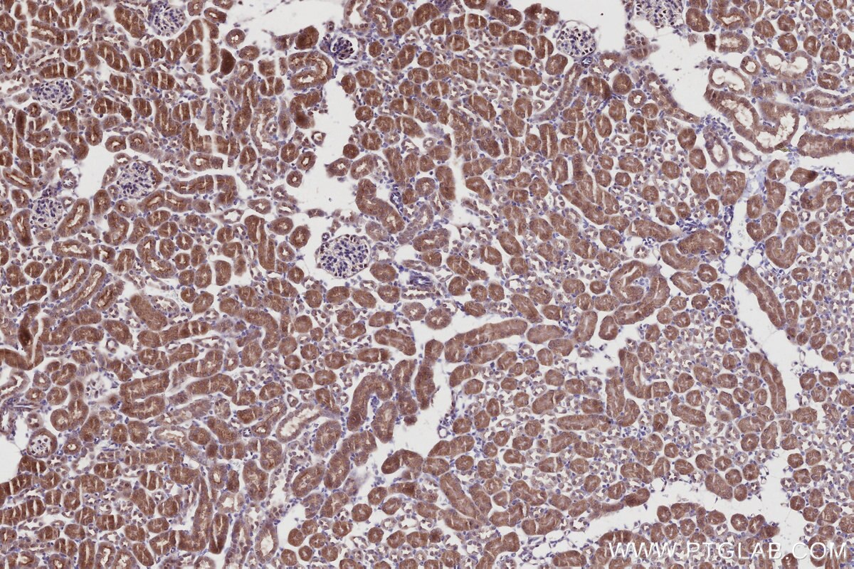 Immunohistochemistry (IHC) staining of mouse kidney tissue using RSPH1 Polyclonal antibody (32033-1-AP)
