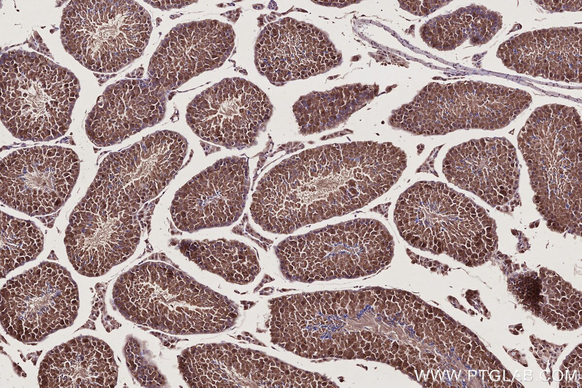 Immunohistochemistry (IHC) staining of mouse testis tissue using RSPH1 Polyclonal antibody (32033-1-AP)