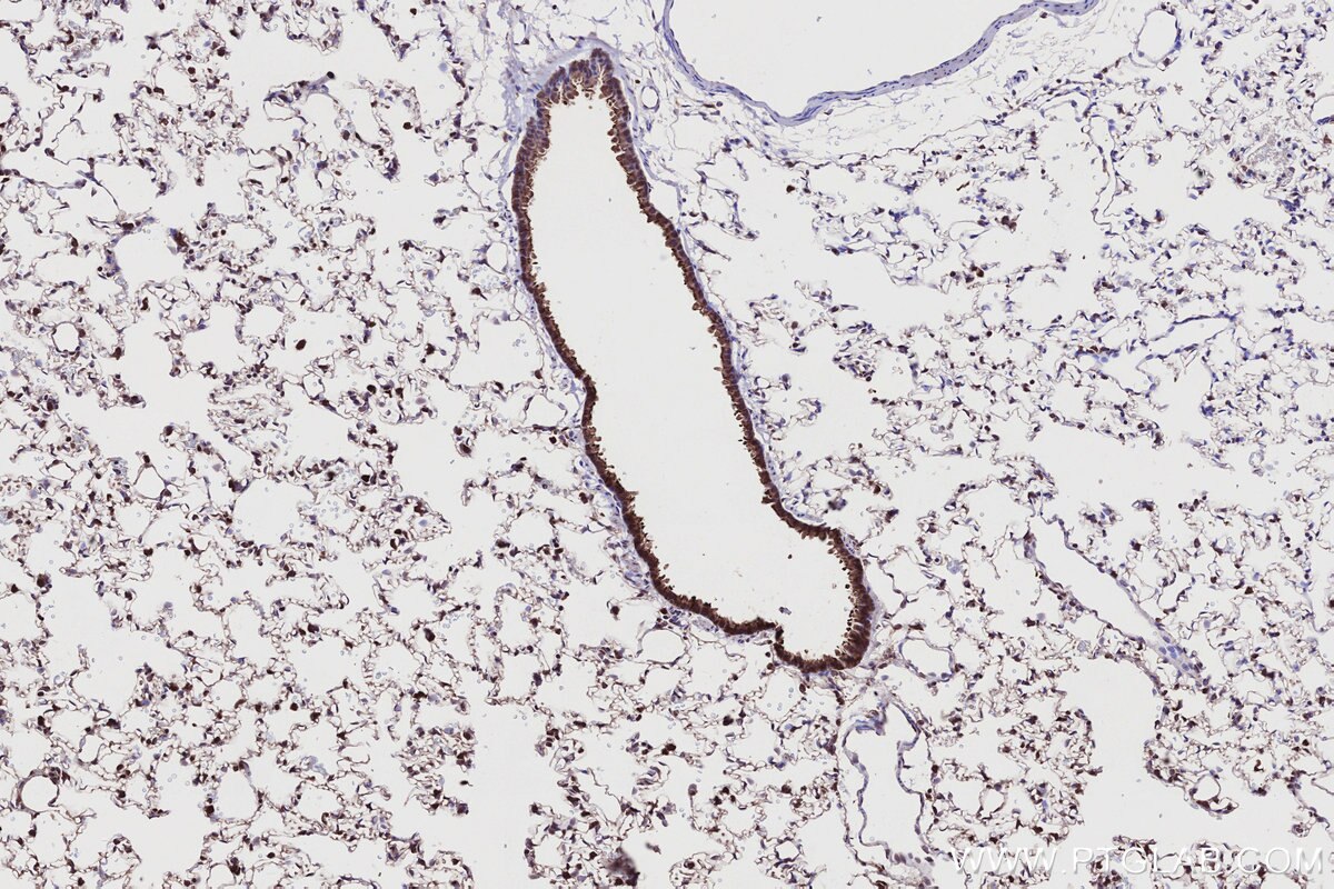 Immunohistochemistry (IHC) staining of rat lung tissue using RSPH1 Polyclonal antibody (32033-1-AP)