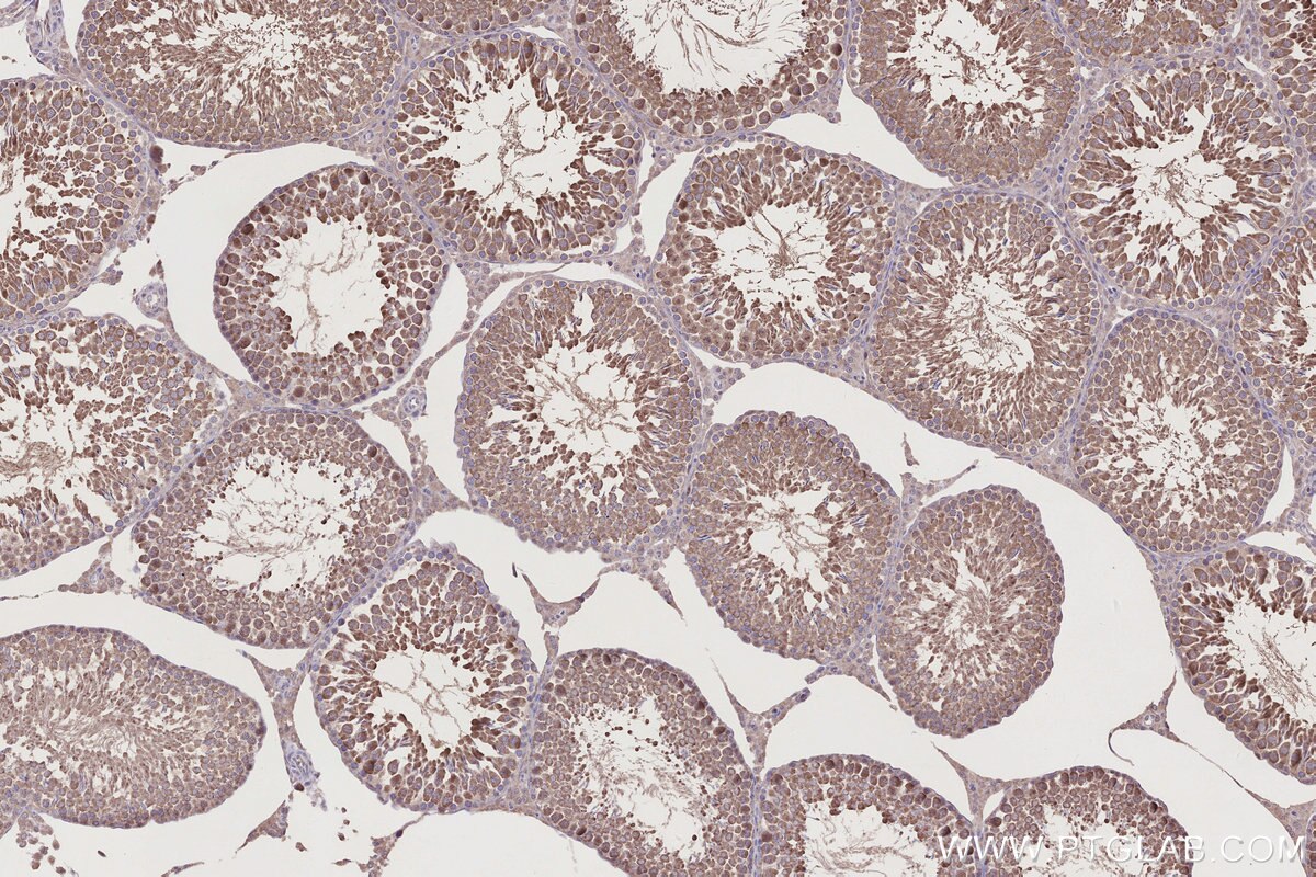 Immunohistochemistry (IHC) staining of rat testis tissue using RSPH1 Polyclonal antibody (32033-1-AP)