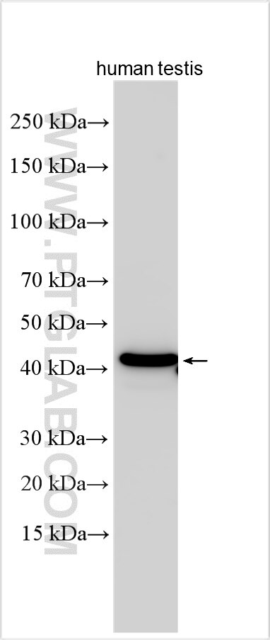 RSPH1