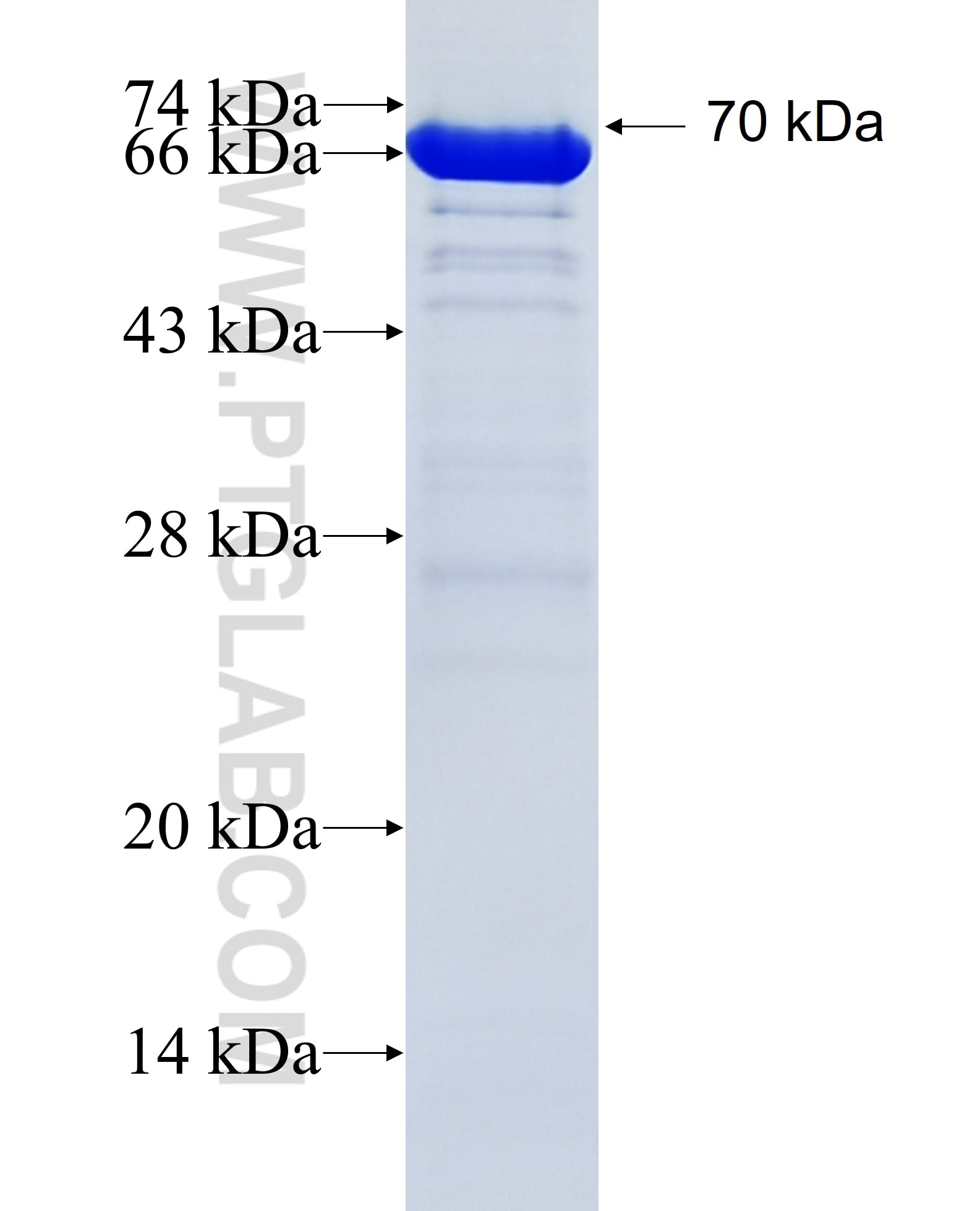 RSPH1 fusion protein Ag36560 SDS-PAGE