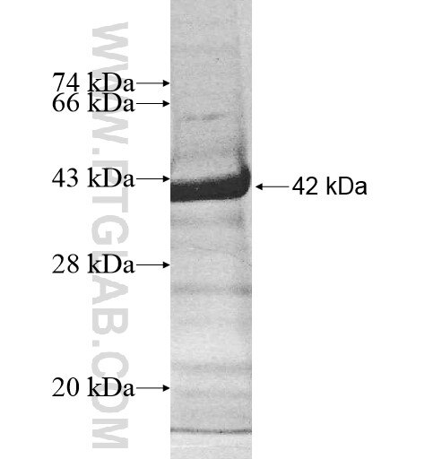 RSPH10B fusion protein Ag10638 SDS-PAGE