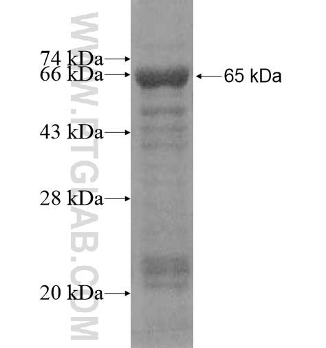 RSPH10B fusion protein Ag10877 SDS-PAGE