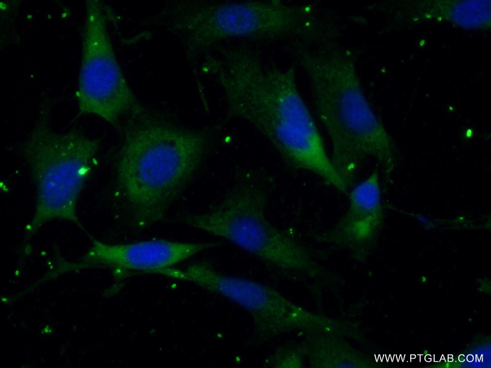 Immunofluorescence (IF) / fluorescent staining of NIH/3T3 cells using RSPH3 Polyclonal antibody (17603-1-AP)