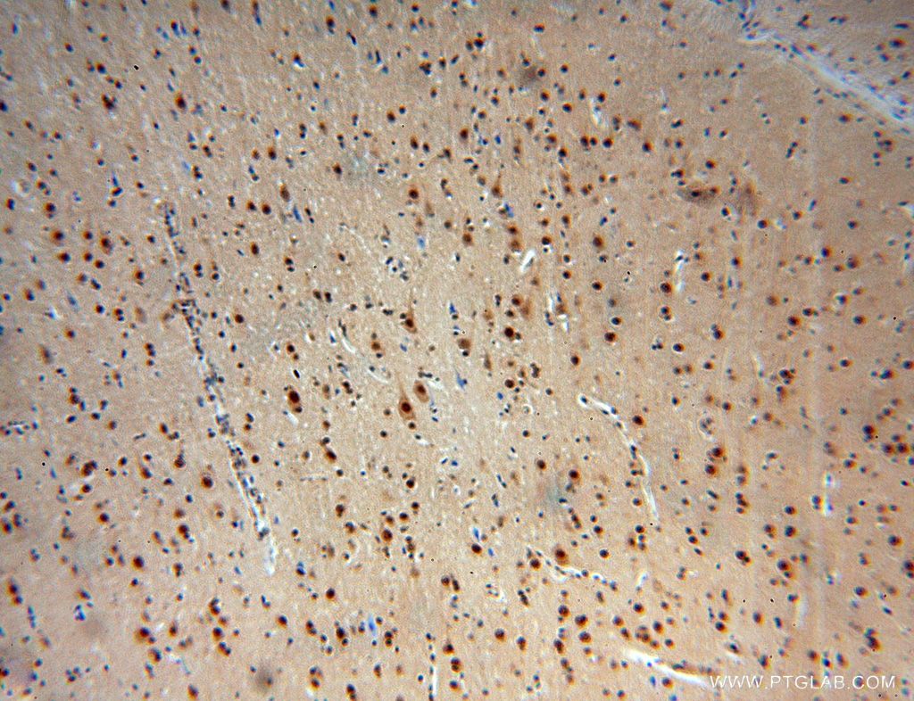Immunohistochemistry (IHC) staining of human brain tissue using RSPH3 Polyclonal antibody (17603-1-AP)