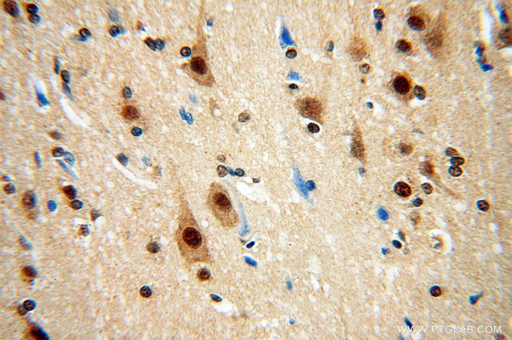 Immunohistochemistry (IHC) staining of human brain tissue using RSPH3 Polyclonal antibody (17603-1-AP)