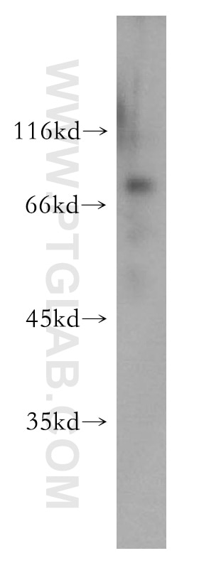 Western Blot (WB) analysis of human brain tissue using RSPH3 Polyclonal antibody (17603-1-AP)