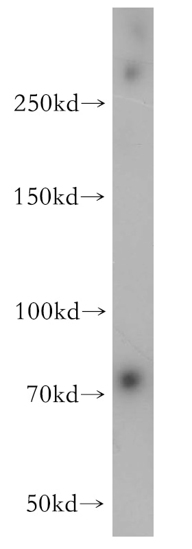 Western Blot (WB) analysis of NIH/3T3 cells using RSPH3 Polyclonal antibody (17603-1-AP)