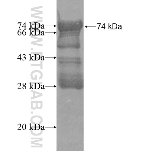 RSPH3 fusion protein Ag11707 SDS-PAGE